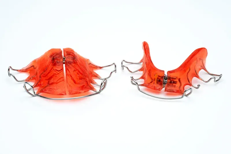 braces retainers orthodontics citrus park odessa